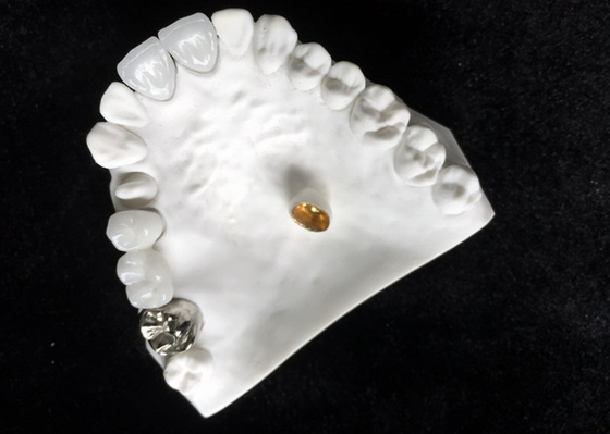 Elevação dental da coroa da boa porcelana de Biocompatibility - material biológico da tecnologia