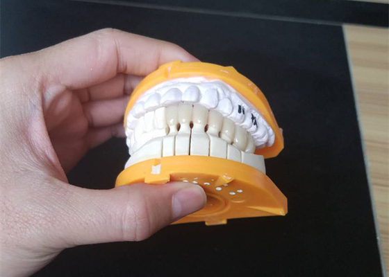 Coroas cerâmicas feitas sob encomenda do tamanho PFM para os dentes traseiros e anteriores