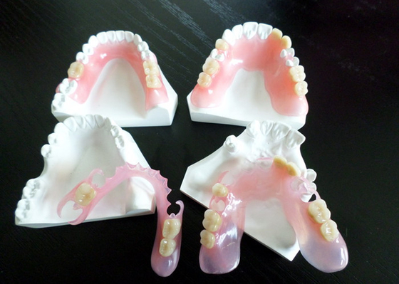 Restauração dental da coroa de Digitas PFM