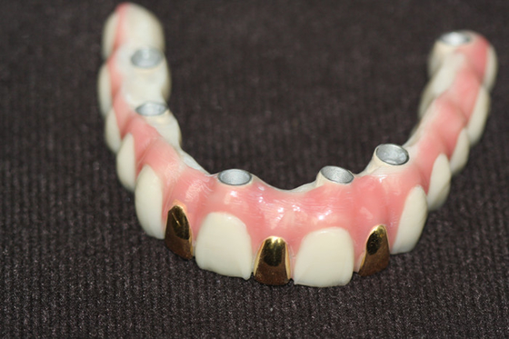 Precisão Digital 3D que imprime o metal da barra do implante dental baseado