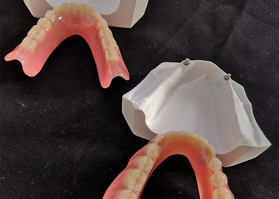O implante dental confortável Overdenture do CAD CAM fácil mantém