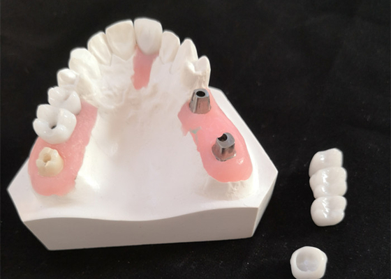 FDA Coroa de zircônio com próteses dentárias implantadas para laboratório dentário