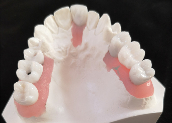 FDA Coroa de zircônio com próteses dentárias implantadas para laboratório dentário
