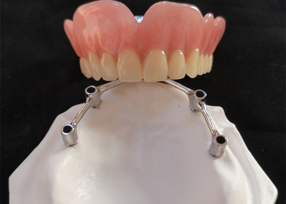 Implantes dentais de FDA da coroa do implante do dente de COCR com barra do titânio