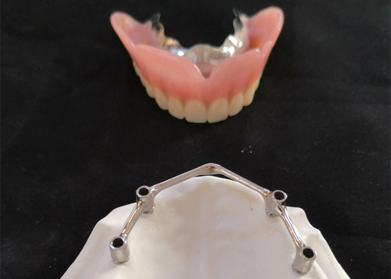 Implantes dentais de FDA da coroa do implante do dente de COCR com barra do titânio