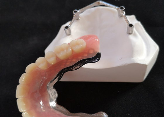 Barras de implantes dentários de titânio/titânio puro para Centro Digital CAD CAM