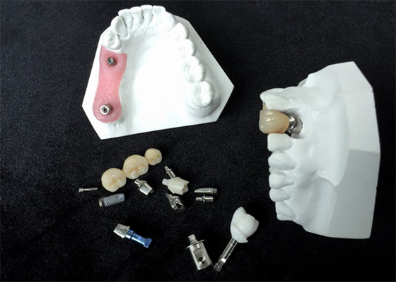 Dentadura alta do acessório de barra da estabilidade dos localizadores feitos sob encomenda do implante dental