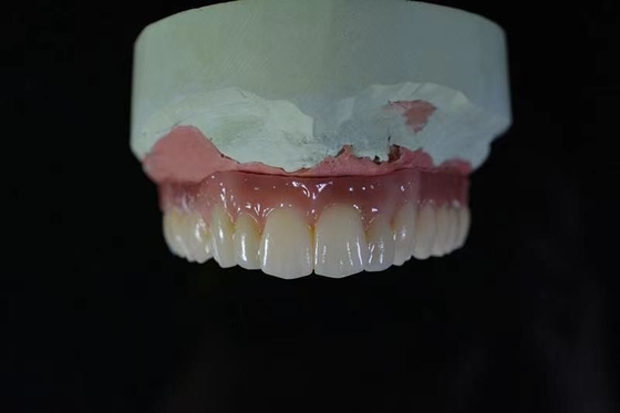 Elevação da barra do implante dental do CAD CAM da segurança da saúde - material biológico da tecnologia
