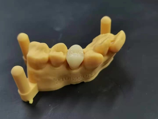 OEM 3D que imprime o projeto dental de Digitas do laboratório da dentadura acrílica flexível