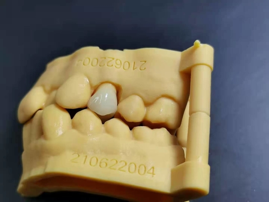 OEM 3D que imprime o projeto dental de Digitas do laboratório da dentadura acrílica flexível
