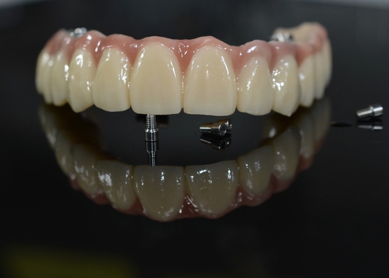 Coroa dental de zircônio: Dentes de aparência natural, duráveis e seguros