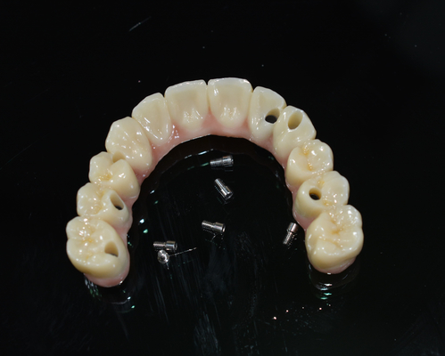 Coroa dental de zircônio: Dentes de aparência natural, duráveis e seguros