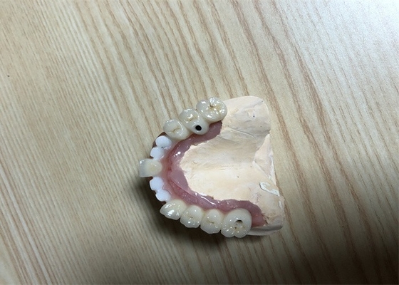 Coroa exata do implante do dente dos acessórios do implante dental de Biocompatibility