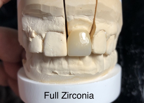 3D multi-nível de contorno completo Zirconia Resolver o problema da falta de transparência