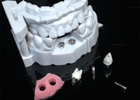 Modelo 3D Coroa de zircônio