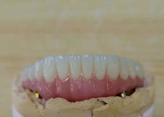 FDA Coroa de zircônio com próteses dentárias implantadas para laboratório dentário