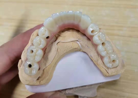 FDA Coroa de zircônio com próteses dentárias implantadas para laboratório dentário