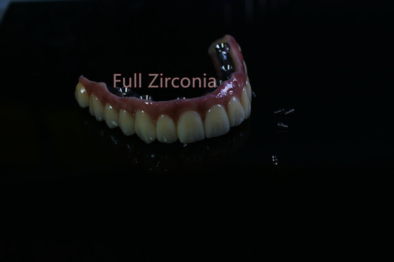 Elevação da barra do implante dental do CAD CAM da segurança da saúde - material biológico da tecnologia