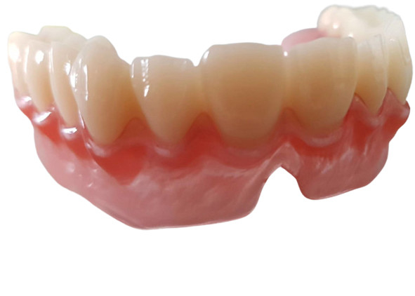 O OEM realístico 3D dos dados de Digitas imprimiu modelos dentais para o dentista Study