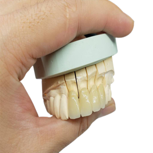 Coroa resistente à corrosão da porcelana do OEM da segurança todo o olhar natural cerâmico