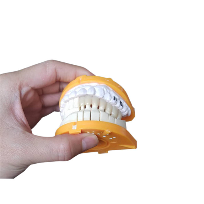 Coroas cerâmicas feitas sob encomenda do tamanho PFM para os dentes traseiros e anteriores