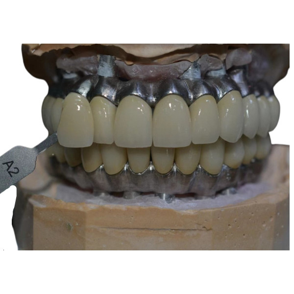 Material biológico apoiado da coroa do metal do Cr do Co implante resistente à corrosão