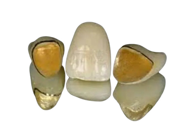 Projeto realístico da numeração da cor dos dentes de superfície lisos da porcelana do metal de PFM