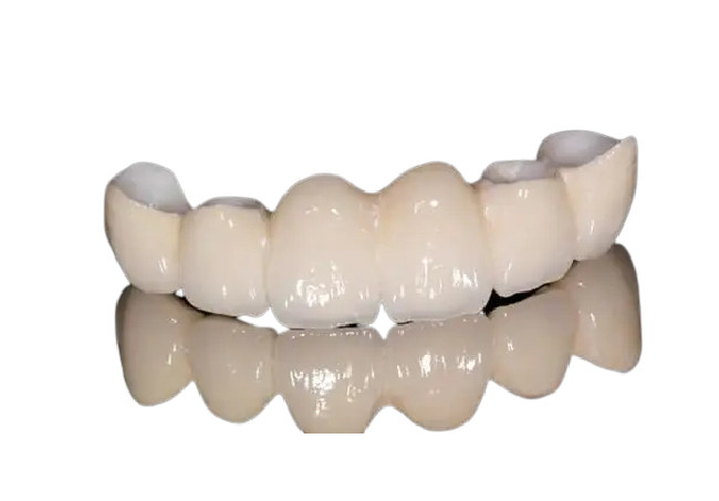 Aparência natural da coroa dental resistente à corrosão da porcelana para Front Teeth/dentes traseiros