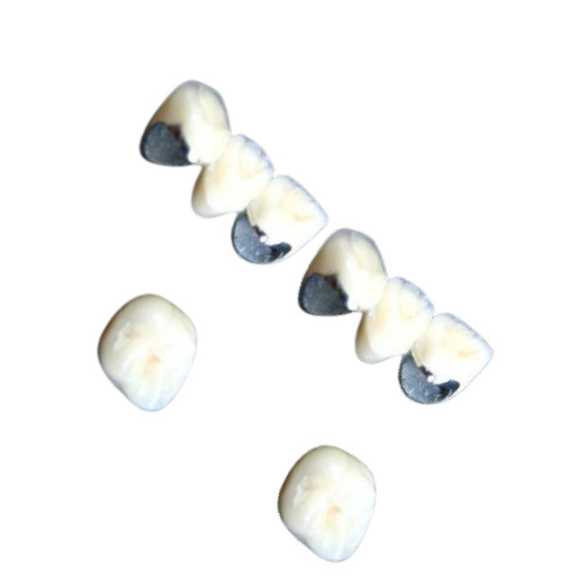 Dentes dentais da porcelana de Chrome do cobalto da coroa da porcelana não alérgica resistentes à corrosão