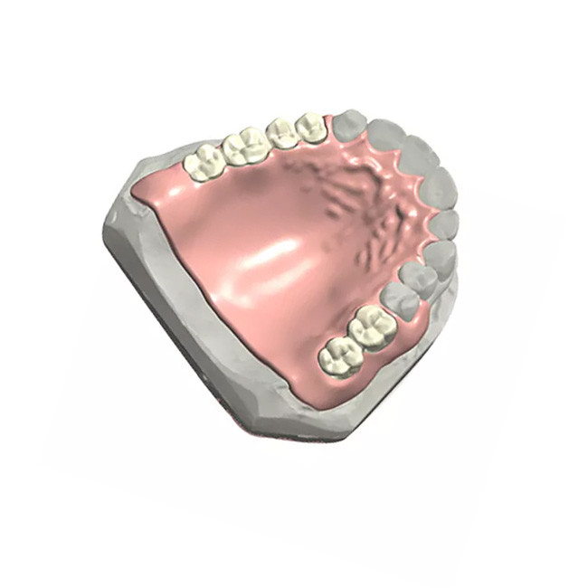 Modelo dental natural Customized da cor 3D da dentadura parcial dental removível