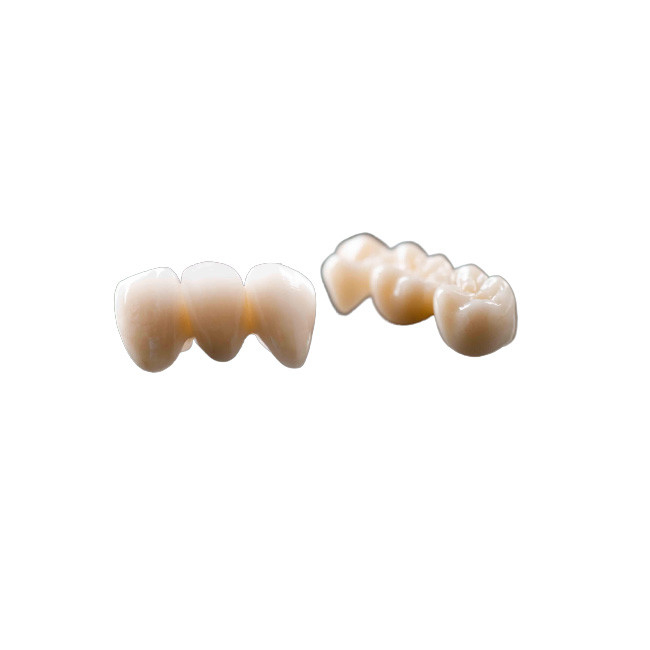 Boa estabilidade da cor natural dental fixa composta da ponte da coroa da coroa da ponte