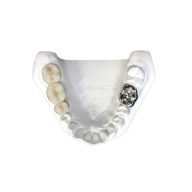 A cor da coroa da porcelana é Stablenot e tem a estabilidade forte