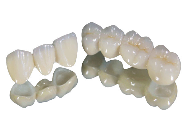 Estábulo forte da cor da resistência de desgaste da coroa do dente da porcelana de alta qualidade