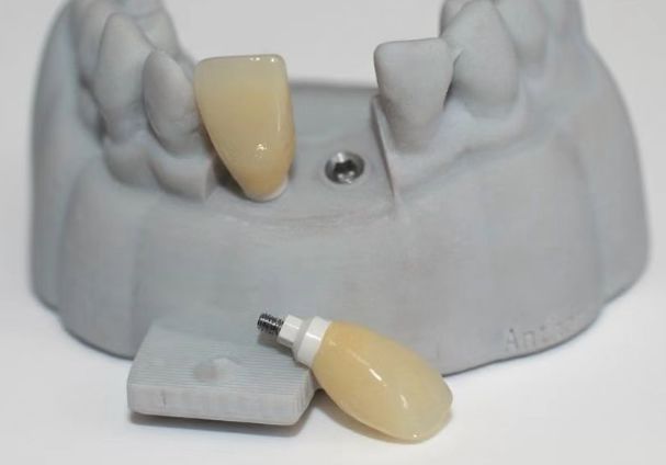 Base CAD PEEK personalizada