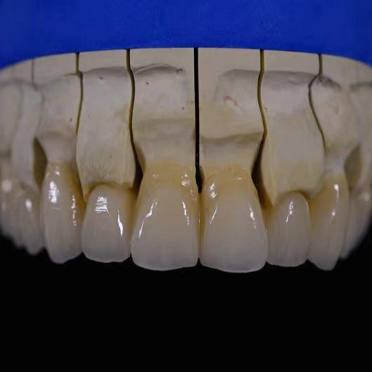 material de porcelana em pó de porcelana Vita VM9
